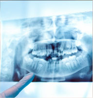 歯肉の状態を診査のイメージ画像